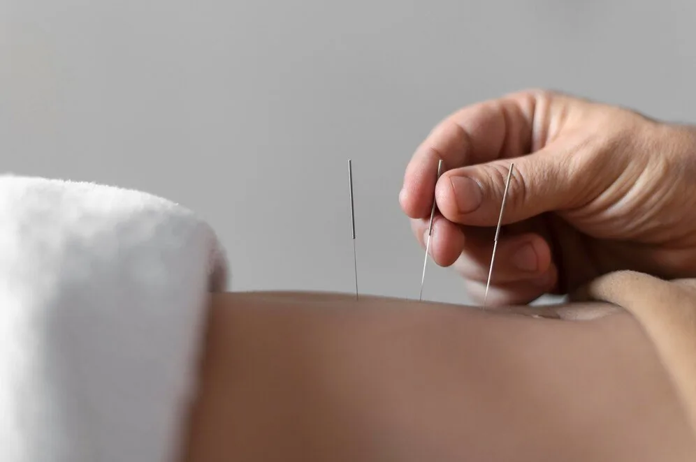 Close up hand holding acupuncture needle 23 2148815311.jpg